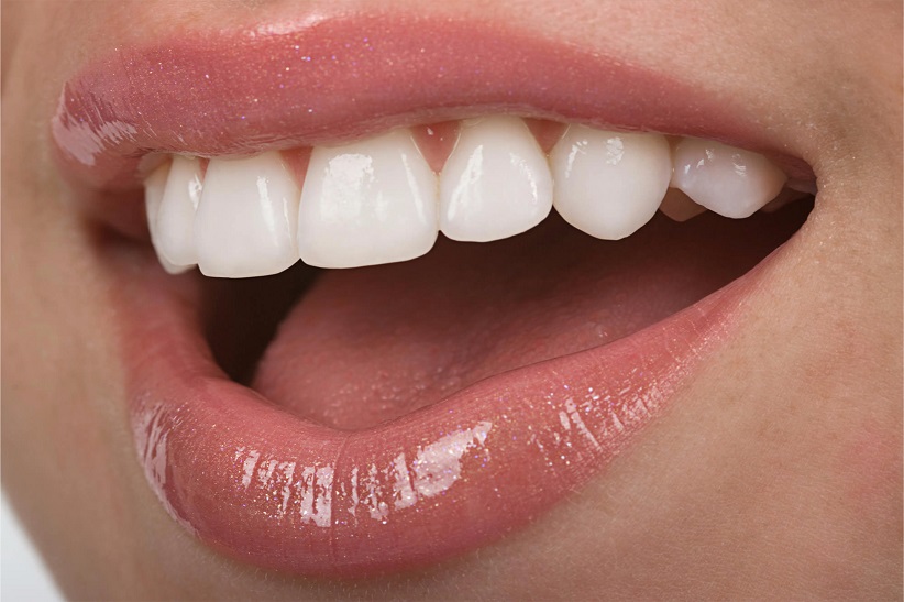 بهترین دندانپزشک متخصص زیبایی دندان شیراز